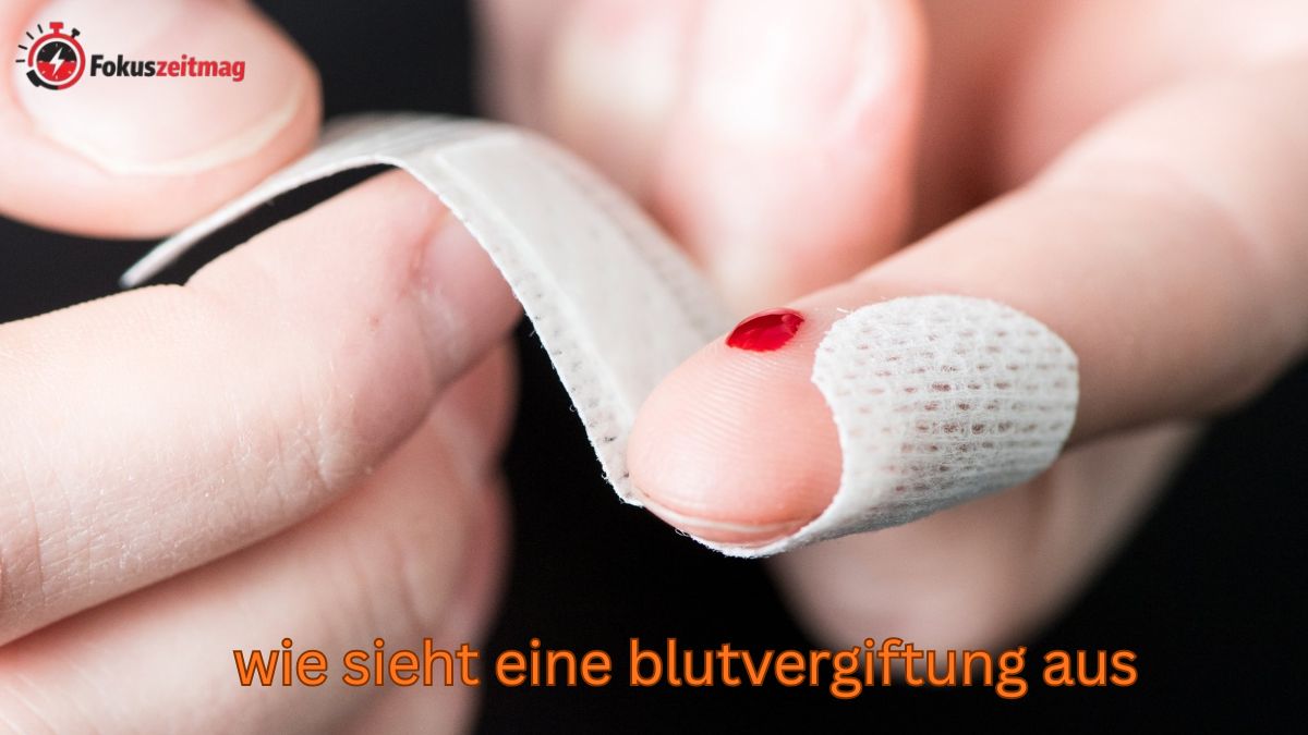 botschafter wie sieht eine blutvergiftung aus